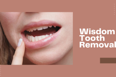 How to Deal with Impacted Wisdom Teeth - Top Dawg Labs