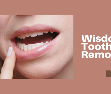 How to Deal with Impacted Wisdom Teeth - Top Dawg Labs