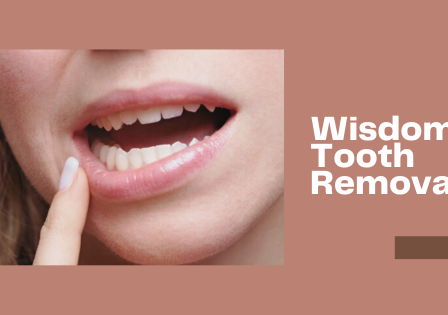 How to Deal with Impacted Wisdom Teeth - Top Dawg Labs