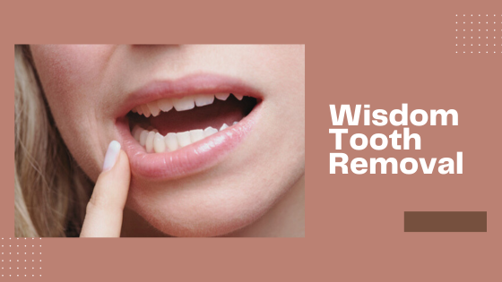How to Deal with Impacted Wisdom Teeth - Top Dawg Labs